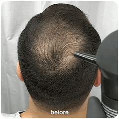 Dexe Hair Building Fibers (Imported)